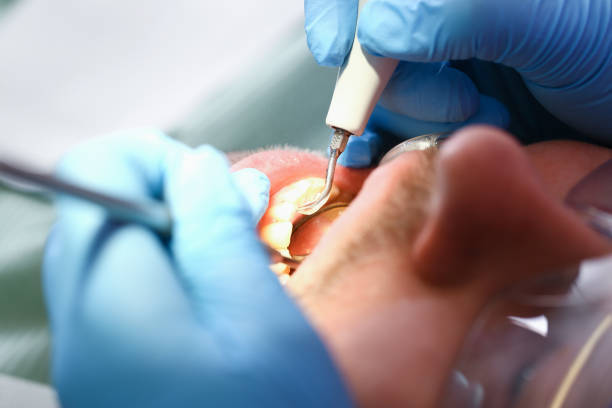 Best Cracked Tooth Emergency Dentist  in Cape St Claire, MD