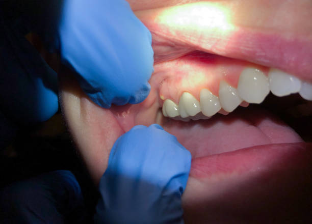 Best Teeth Whitening  in Cape St Claire, MD