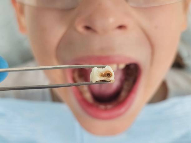 Best Teeth Whitening  in Cape St Claire, MD